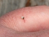 Stachel im Finger