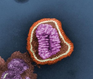 virus©flickr.com/kat-m-research