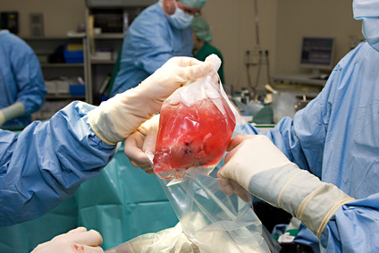Der Artikel regt zum Leben retten in Form von Blutplasmaspenden an. 
