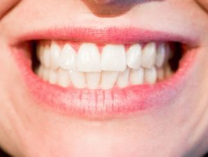Gesunde Zähne für einen fitten und gesunden Körper