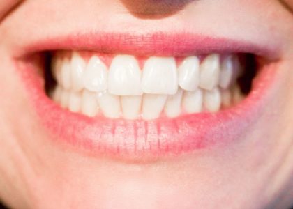 Gesunde Zähne für einen fitten und gesunden Körper