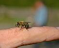 Insektengiftallergie: Vorbeugung schützt vor schweren Folgen