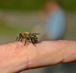 Insektengiftallergie: Vorbeugung schützt vor schweren Folgen