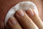 Behandlungsmöglichkeiten bei der Hautkrankheit Rosazea